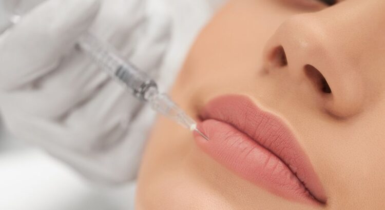 Achieve Luscious Lips with the Help of Lip Fillers